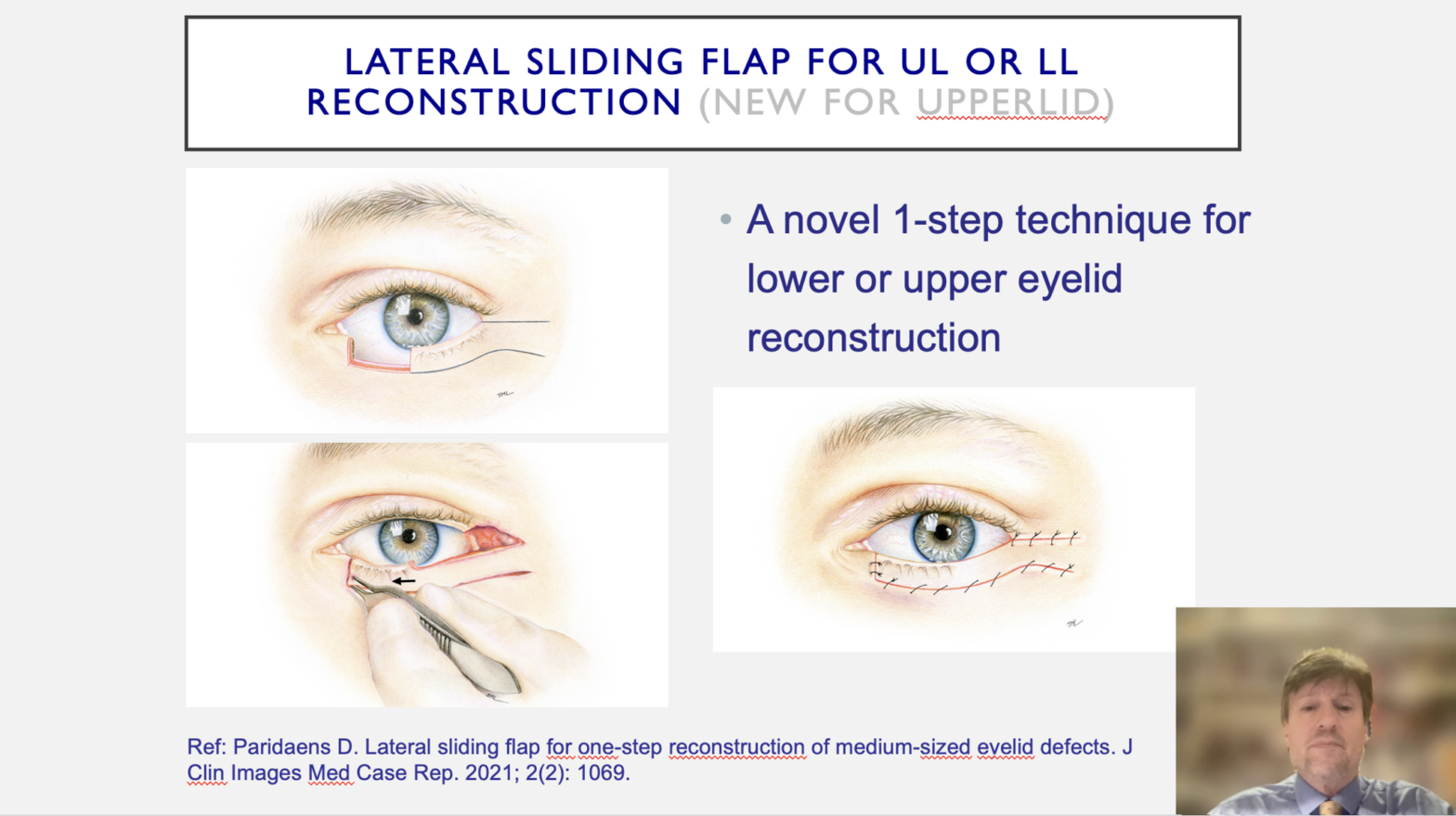Dr Paridaens lectures at Al Qassimi International Ophthalmology Conference